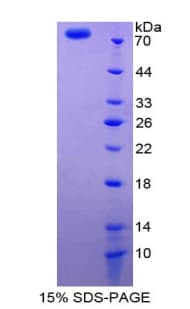 Mouse GC / Vitamin D-Binding Protein (Recombinant His-GST)