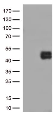CD38 Antibody (aa43-300, clone UMAB263)