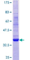Human CNIH1 / CNIH Protein (Recombinant GST)