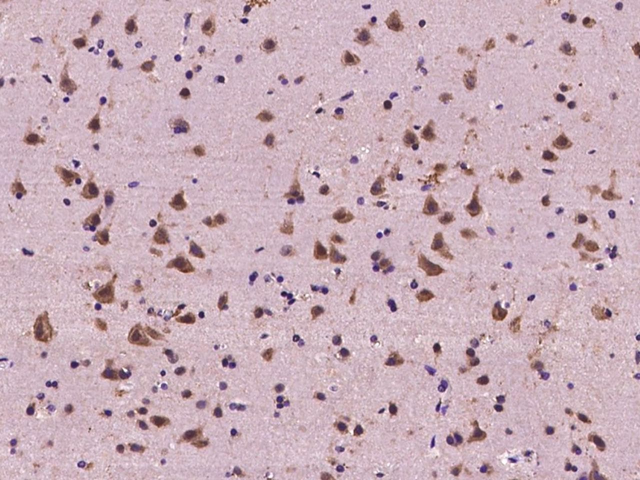 Polyclonal Rabbit anti-Human FXR1 Antibody (IHC, IF, WB)