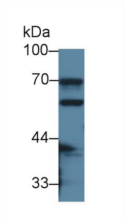 Carboxylesterase 1 / CES1 Antibody (APC)
