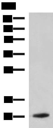 PPY / Pancreatic Polypeptide Antibody