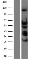 TEAD4 Protein (Over-Expression Lysate Myc-DDK (Flag))