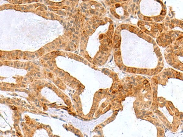 RPS16 / Ribosomal Protein S16 Antibody