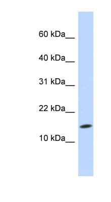 UBE2D3 / UBCH5C Antibody (N-Terminus)