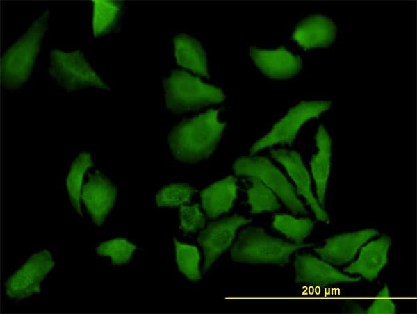 Monoclonal Mouse anti-Human BUB1B / BubR1 Antibody (clone 2G9, IF, WB)