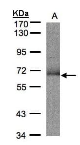 SUOX / Sulfite Oxidase Antibody (aa1-291)