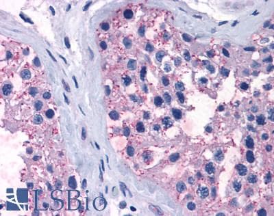 PathPlus™ T1R1 / TAS1R1 Antibody (Cytoplasmic Domain)