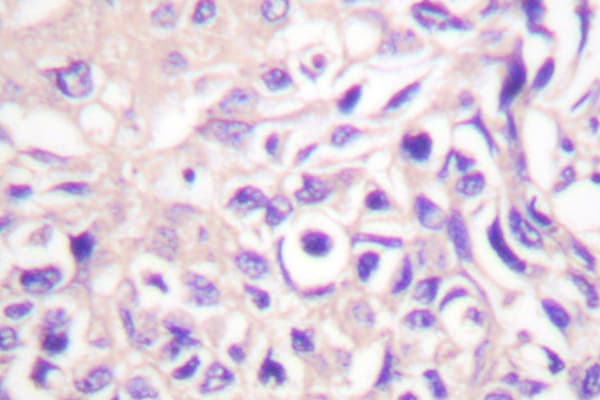 UBE1L / UBA7 Antibody (Glu996)