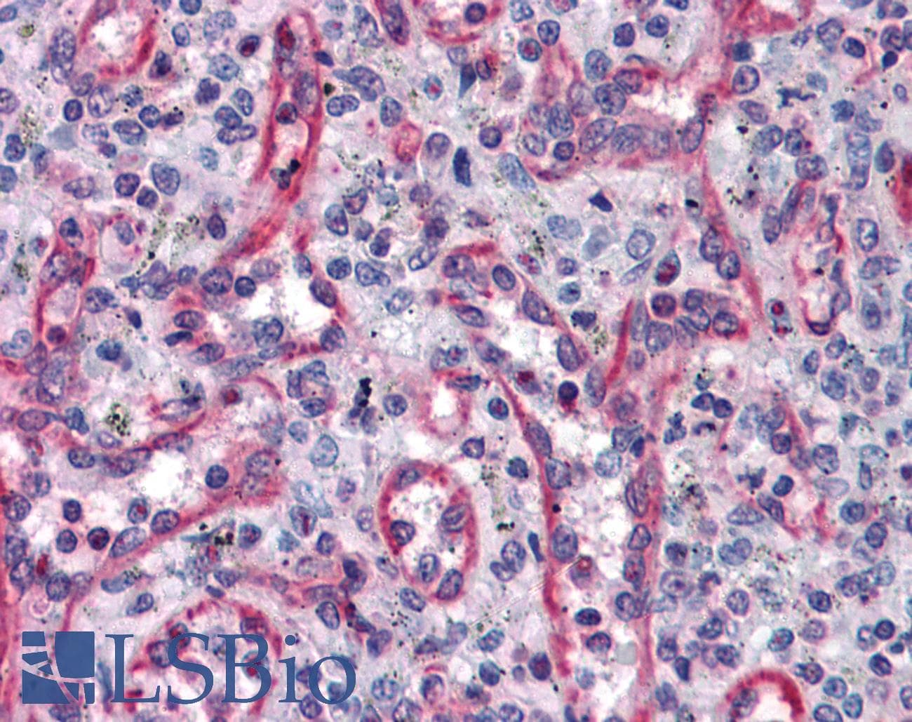 IHC-plus™ Monoclonal Mouse anti-Human TUBA4A / TUBA1 Antibody (clone 2E11, IHC, IF, WB)