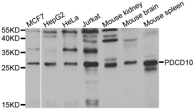 Polyclonal Rabbit anti-Human PDCD10 Antibody (IHC, WB)
