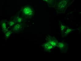 MAWDBP / PBLD Antibody (clone OTI7G5, Carrier-free)