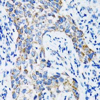 STAT3 Antibody