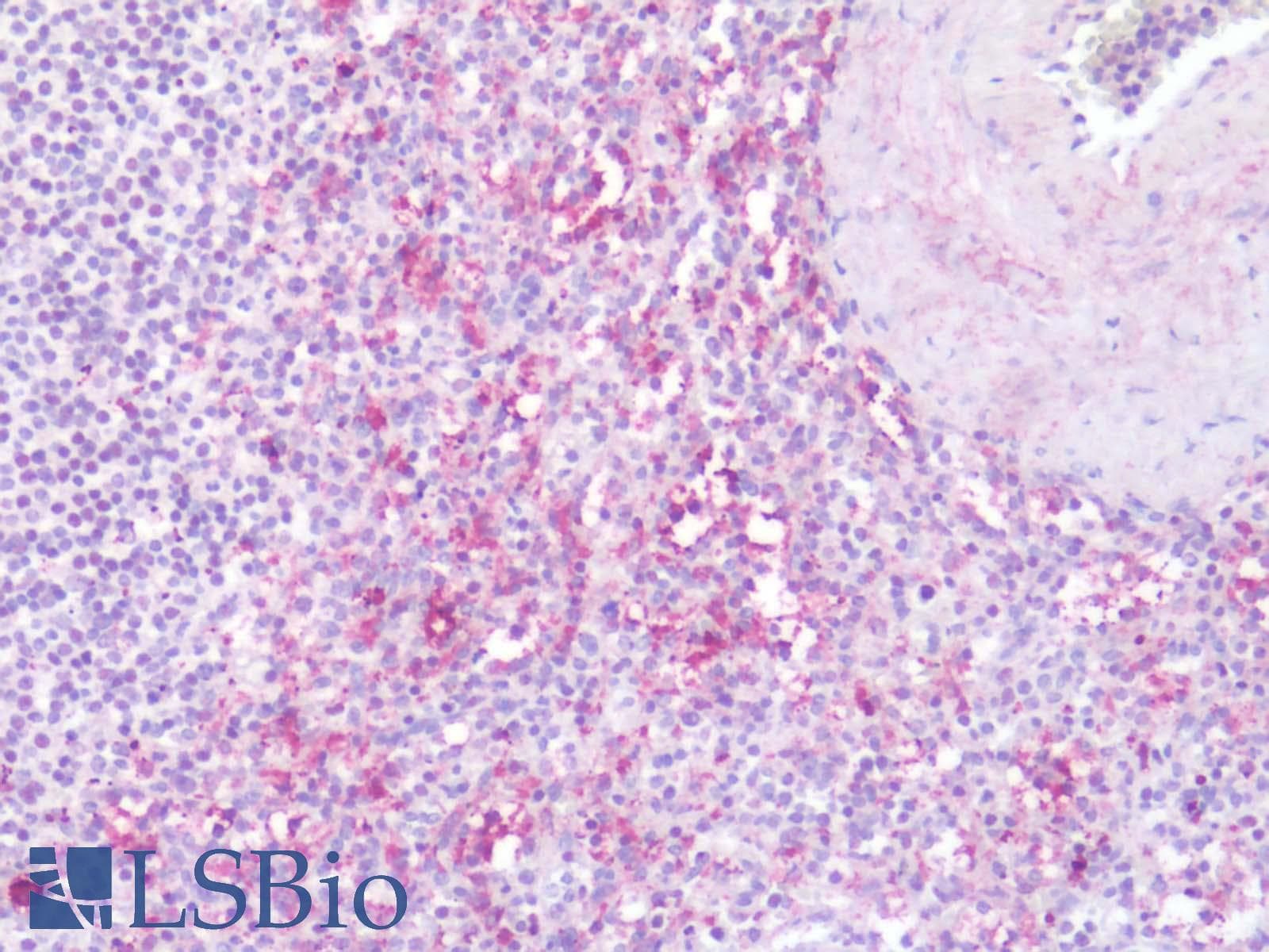 PathPlus™ Leukotriene B4 Receptor / BLT1 Antibody (Cytoplasmic Domain)