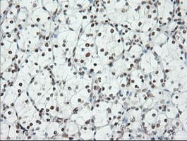ERCC1 Antibody (clone 2.00E+12)