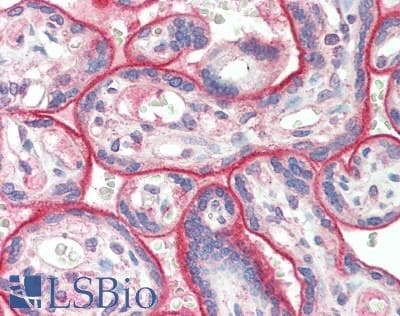 IHC-plus™ Monoclonal Mouse anti-Human VSIR / GI24 / VISTA Antibody (clone 4C4, IHC, IF, WB)