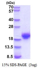 Human CST7 / Cystatin F Protein (Recombinant His)