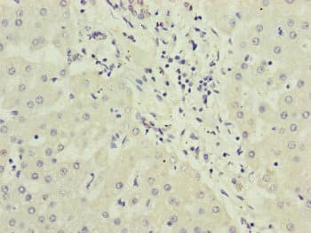 Polyclonal Rabbit anti-Human PPP2R3B Antibody (IHC, WB)