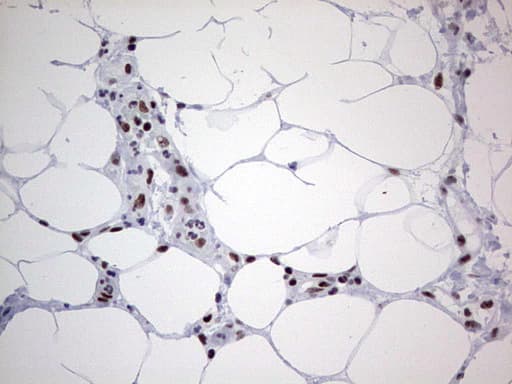 Monoclonal Mouse anti-Human HDAC9 Antibody (clone OTI7G2, aa181-460, IHC, WB)