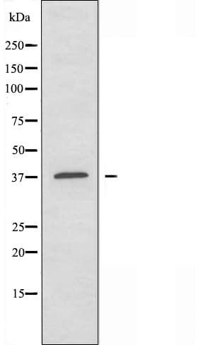 Polyclonal Rabbit anti-Human ANXA10 / Annexin A10 Antibody (IF, WB)