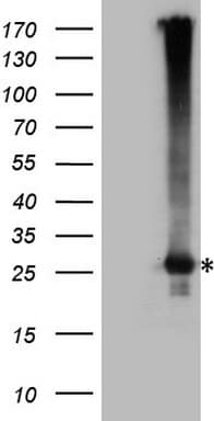 EXOSC1 / CSL4 Antibody (clone OTI4B7)