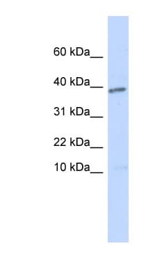 Polyclonal Rabbit anti-Human LEFTYB / LEFTY1 Antibody (N-Terminus, IHC, WB)