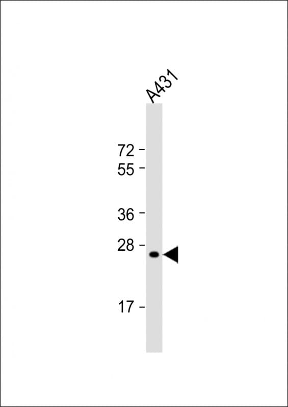 RAB5B Antibody (clone 1615CT668.28.45)