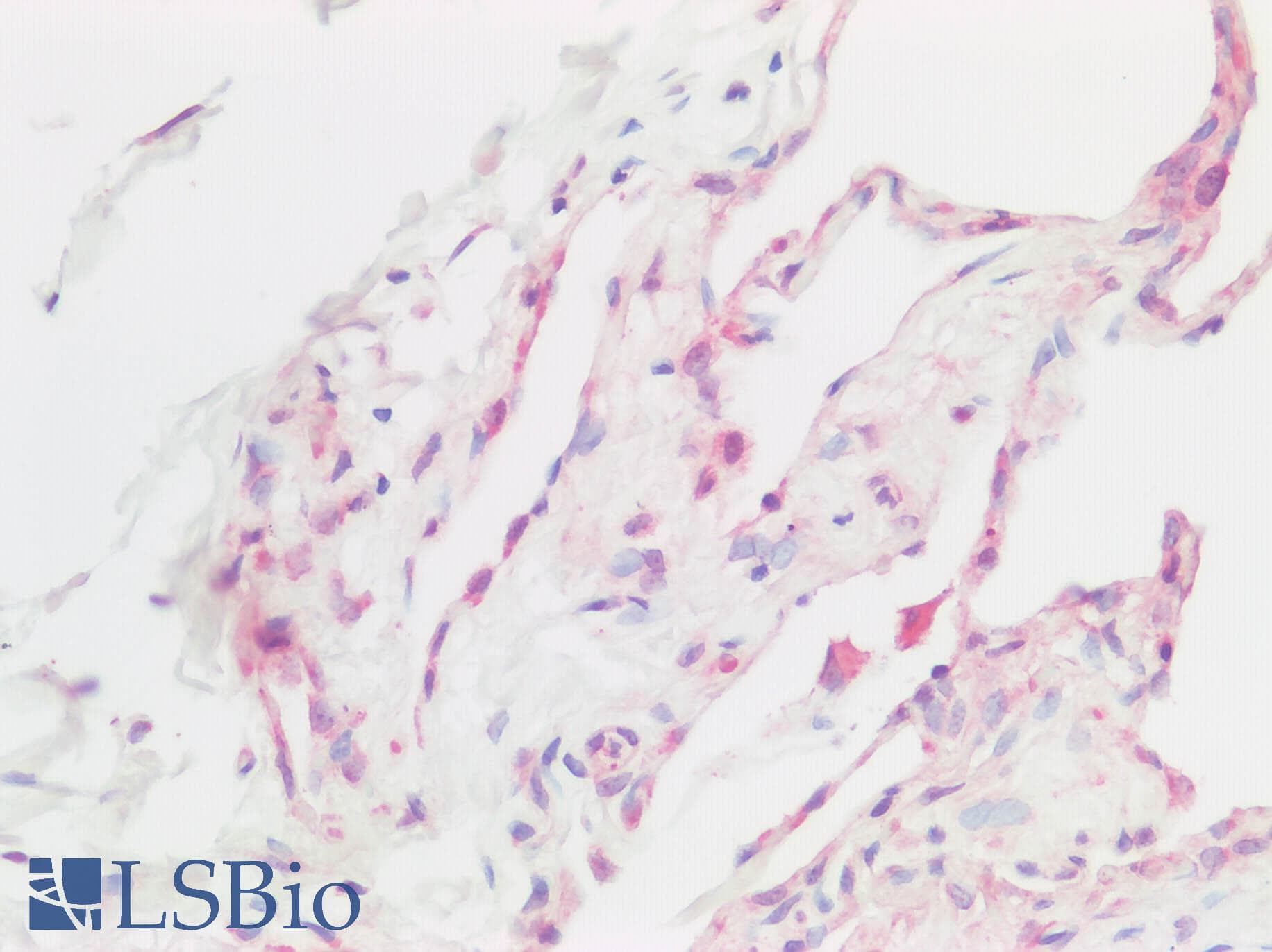 PathPlus™ Polyclonal Rabbit anti-Human BMP6 Antibody (IHC)