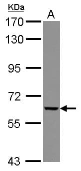 GGTLA1 / GGT5 Antibody