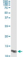 LGALS1 / Galectin 1 Antibody (clone 1E8-1B2)