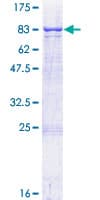 Human TPP1 / CLN2 Protein (Recombinant GST)