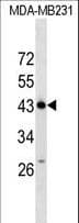 ZNF550 Antibody (aa68-94)