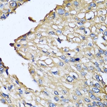 Polyclonal Rabbit anti-Human ASIP Antibody (IHC, IF)
