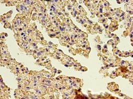 GSN / Gelsolin Antibody (aa28-782)