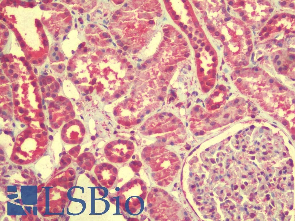 IHC-plus™ Polyclonal Chicken anti-Human ZGPAT Antibody (IHC, IF, WB)