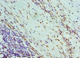 Polyclonal Rabbit anti-Human NONO / P54NRB Antibody (aa1-300, IHC)