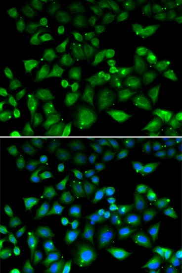 Polyclonal Rabbit anti-Human MALIN / NHLRC1 Antibody (IHC, IF, WB)