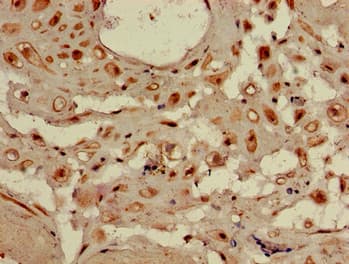 WDR19 Antibody