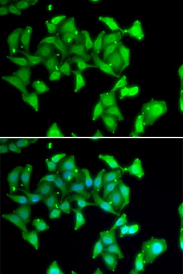 Polyclonal Rabbit anti-Human MYO1C Antibody (IHC, IF, WB)