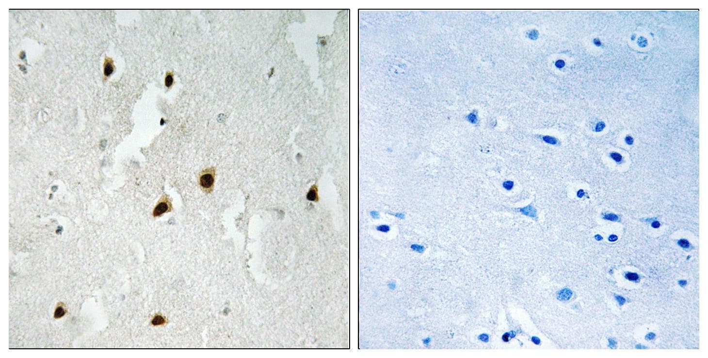FOXO4 / AFX1 Antibody (phospho-Ser262)