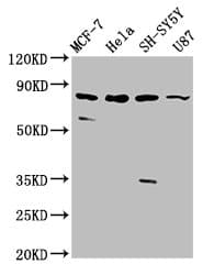 Polyclonal Rabbit anti-Human IL1RAPL1 Antibody (IHC, IF, WB)