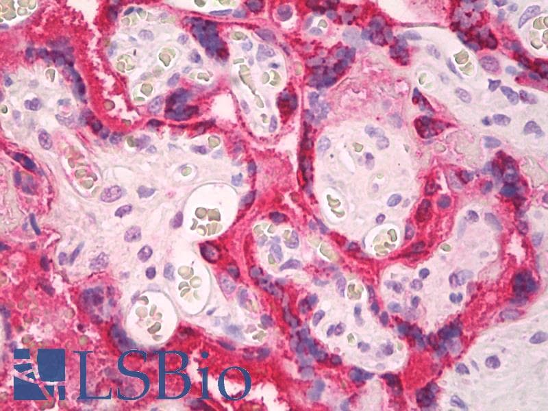 IHC-plus™ Polyclonal Goat anti-Human CGA / hCG Alpha Antibody (IHC)