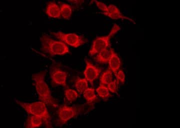 HLA-A Antibody
