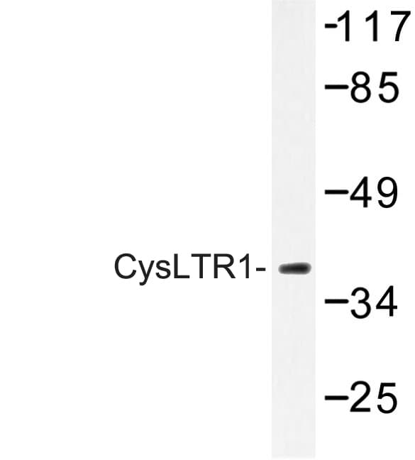 CYSLTR1 / CYSLT1 Antibody (Cys173)
