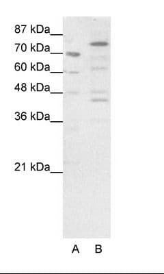 Polyclonal Rabbit anti-Human Eomesodermin / EOMES Antibody (N-Terminus, IHC, WB)