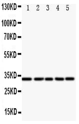 E2F6 Antibody (aa162-177)