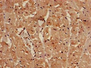 Polyclonal Rabbit anti-Human SULF2 / Sulfatase 2 Antibody (IHC, IF, WB)