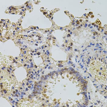 PLK4 / SAK Antibody