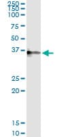 CRHBP Antibody (clone 3D9)