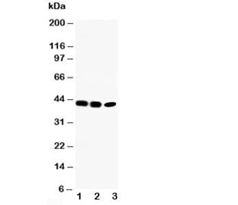 CCR6 Antibody (aa358-374)